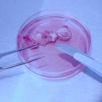 Aufbereitung von Ovargewebe vor Kryokonservierung